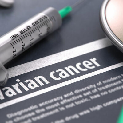 Ovarian Cancer – Diagnosis and Treatment