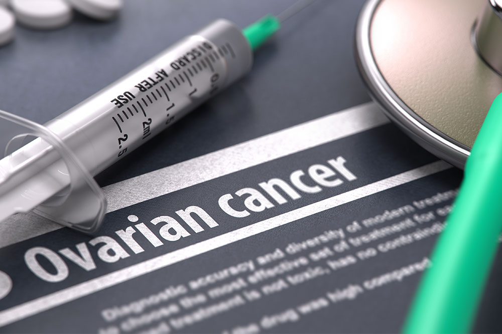 Ovarian Cancer – Diagnosis and Treatment