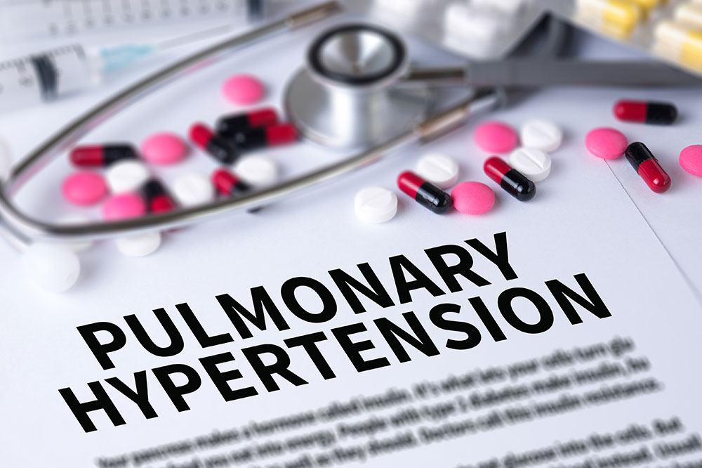 Understanding the Treatment Options for PAH