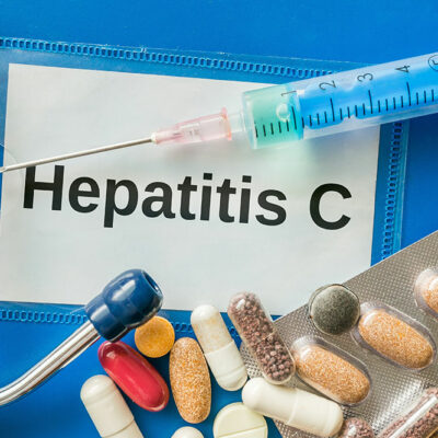 4 Tips to Manage Hepatitis C
