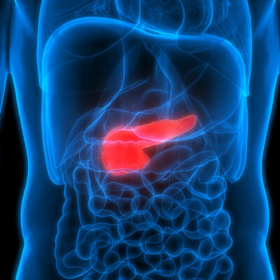 6 Common Risk Factors for Pancreatic Cancer