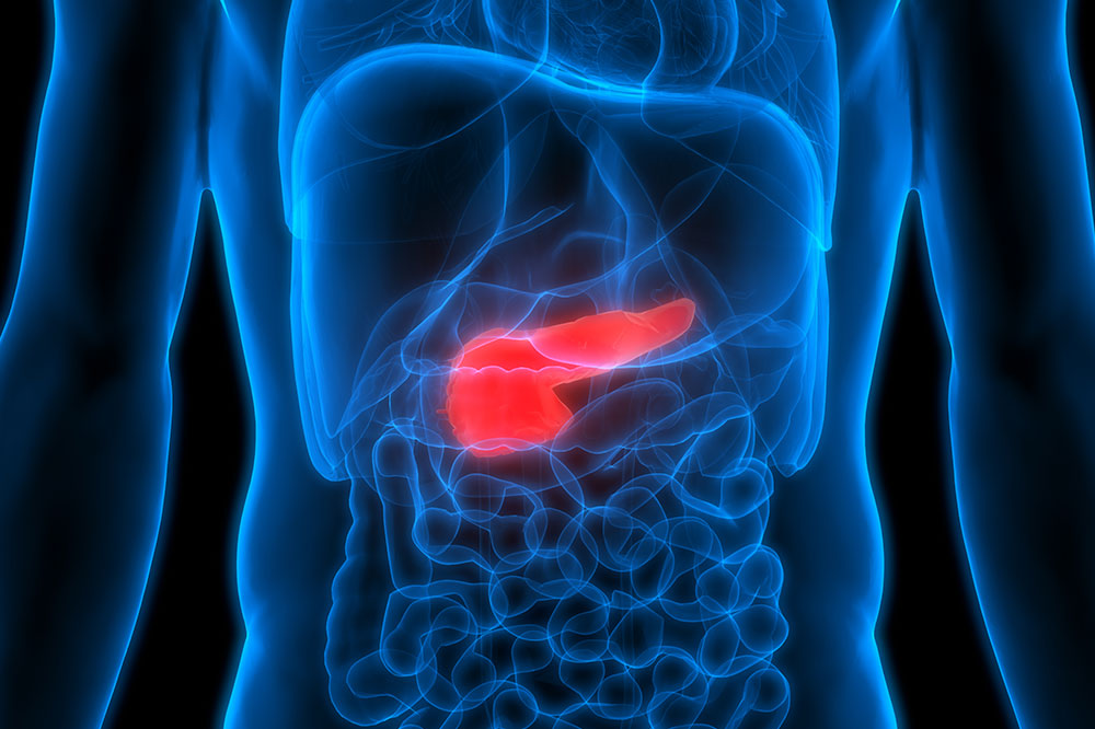 6 Common Risk Factors for Pancreatic Cancer