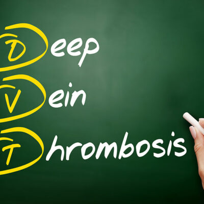 7 Common Symptoms of Deep Vein Thrombosis