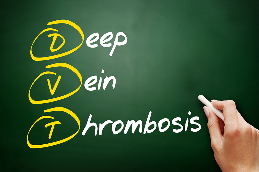 7 Common Symptoms of Deep Vein Thrombosis