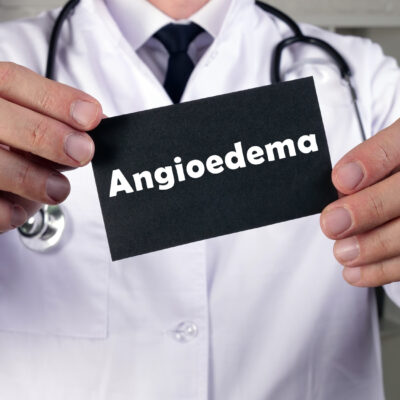 5 Foods That Should Be Avoided With Angioedema